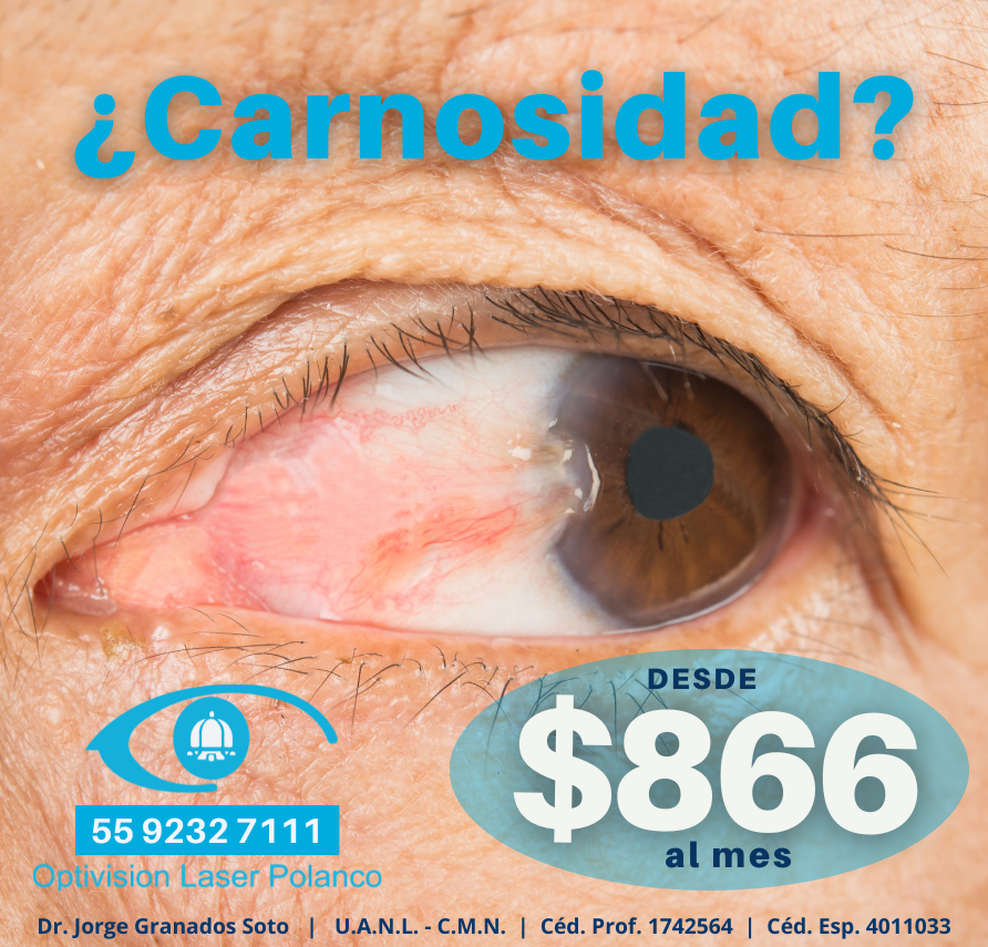 carnosidad750